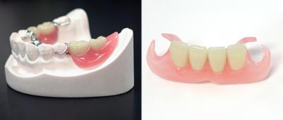 保険適用部分入れ歯