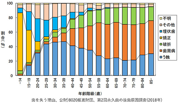 歯科検診・予防歯科の重要性